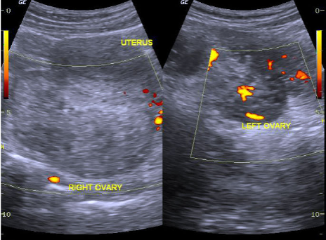 June 2020: Ovarian Torsion Myths episode artwork