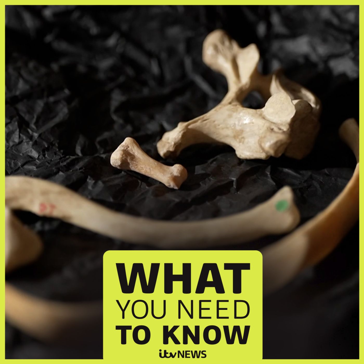 The multimillion pound human remains industry