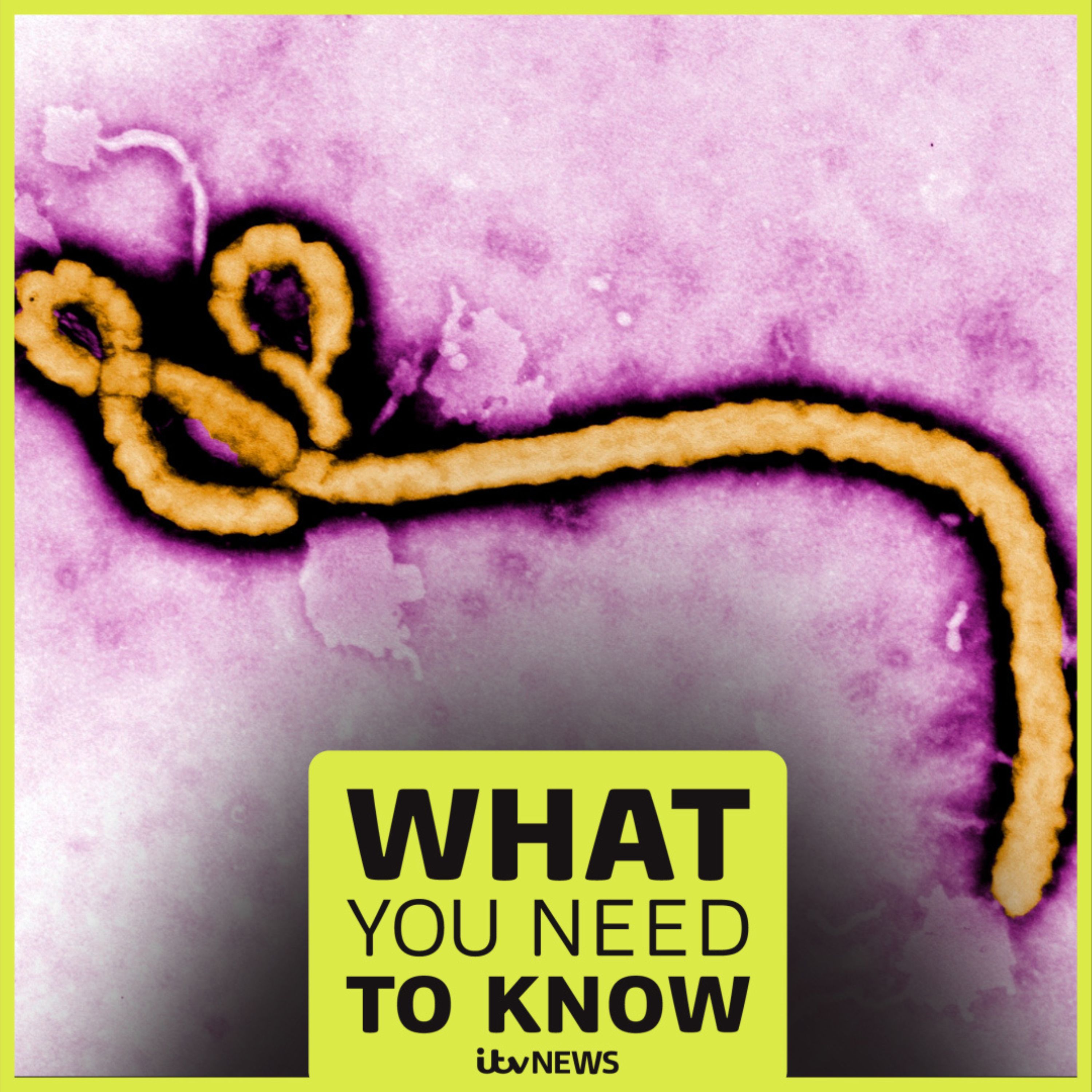 The new Ebola virus outbreak, explained