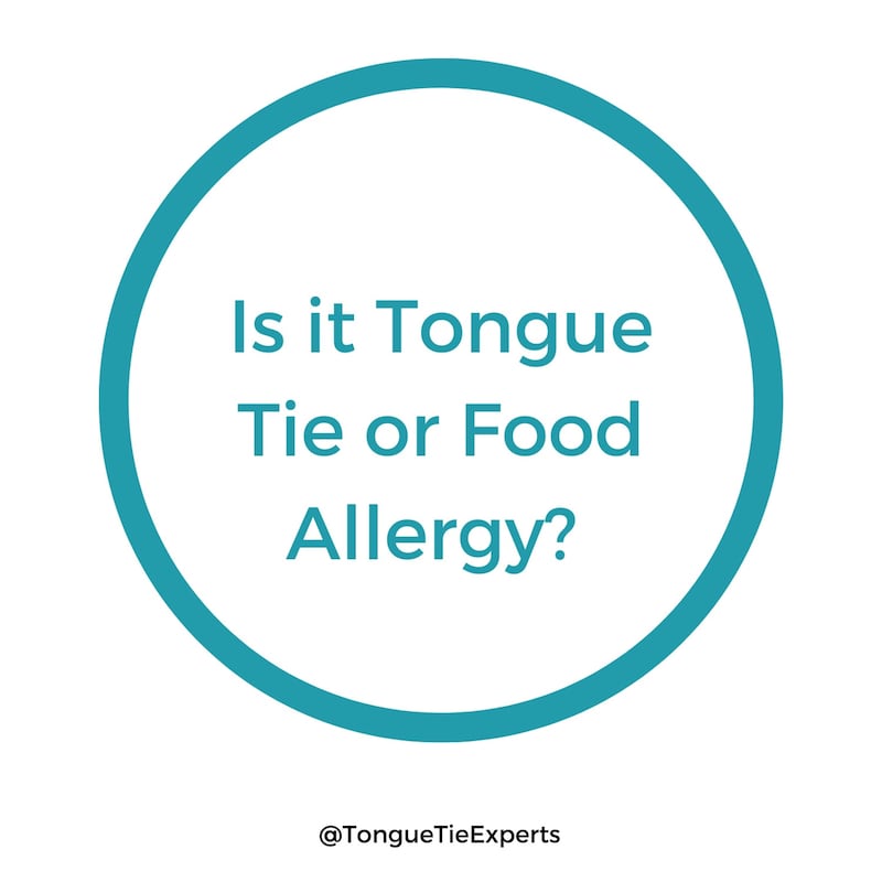 Artwork for podcast The Tongue Tie Experts Podcast