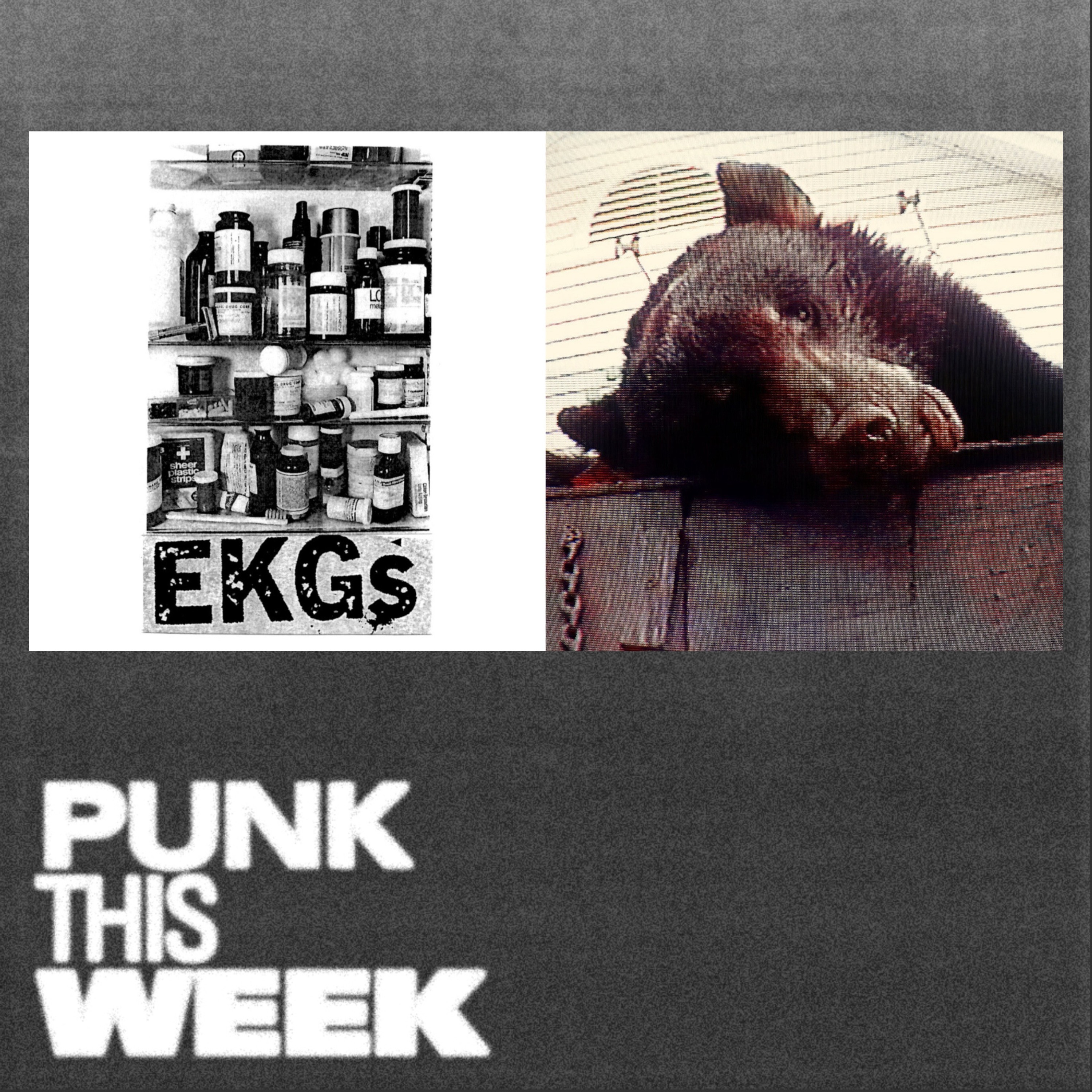 24: EKGs & Truck Violence