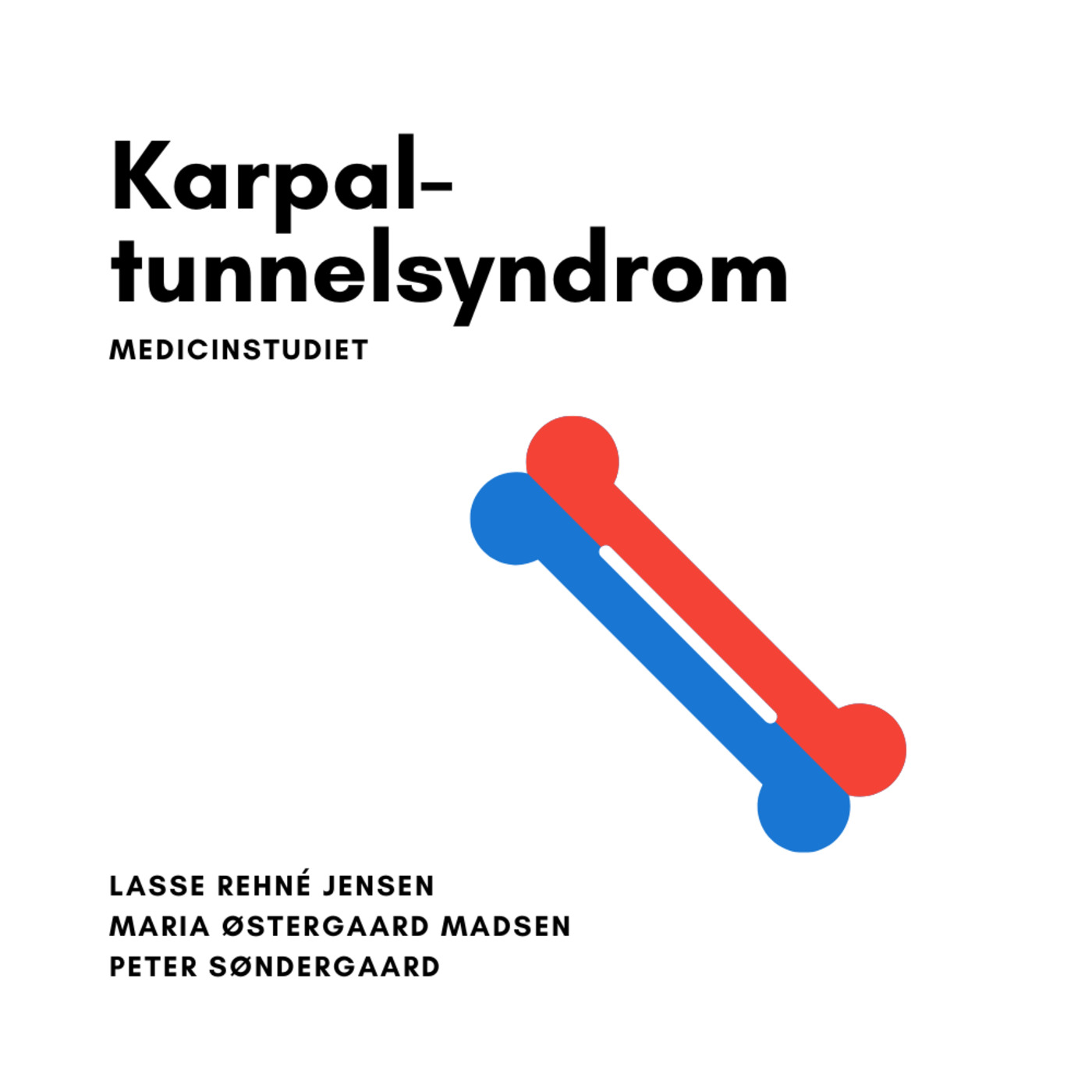 Karpaltunnelsyndrom