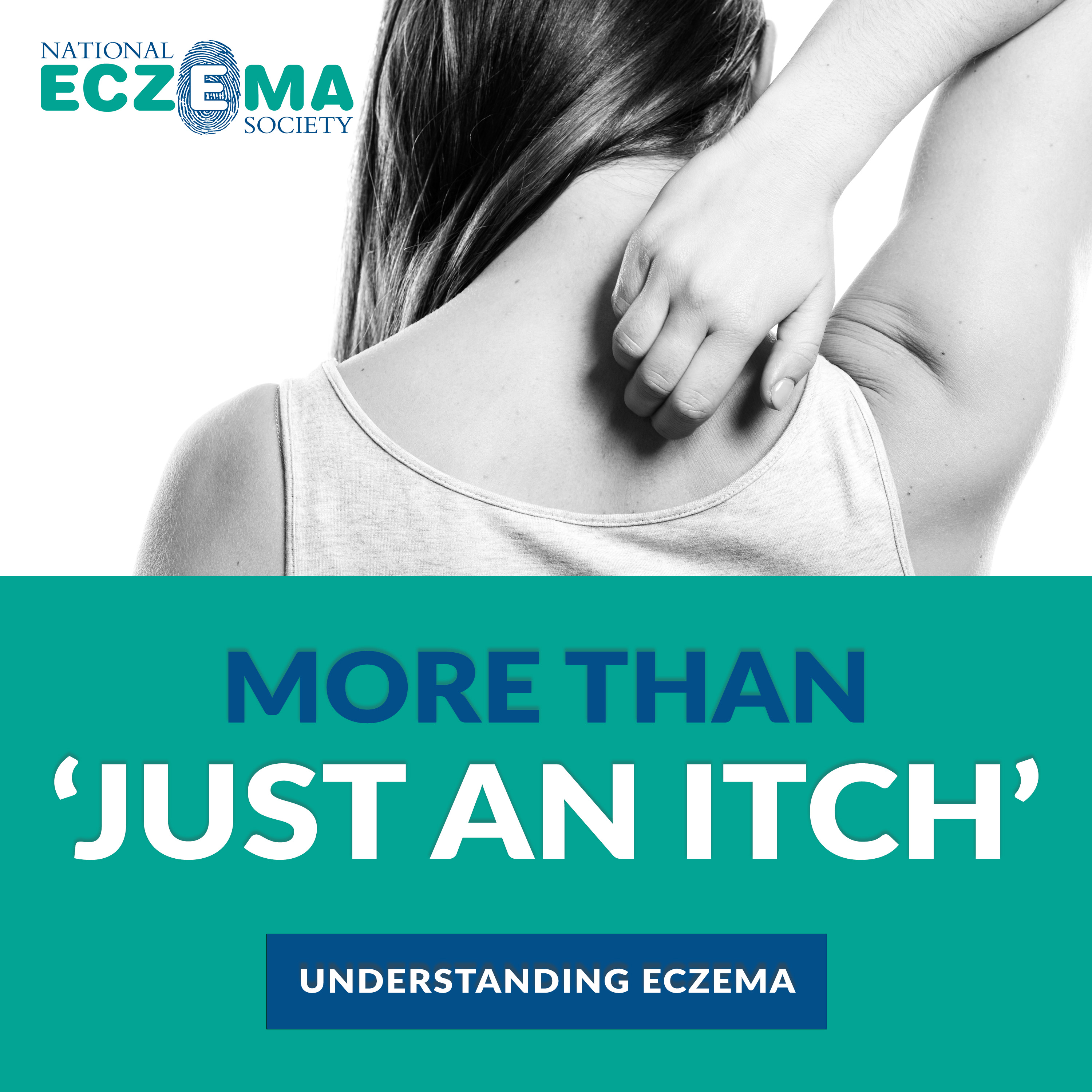 Artwork for More Than "Just An Itch": Understanding Eczema