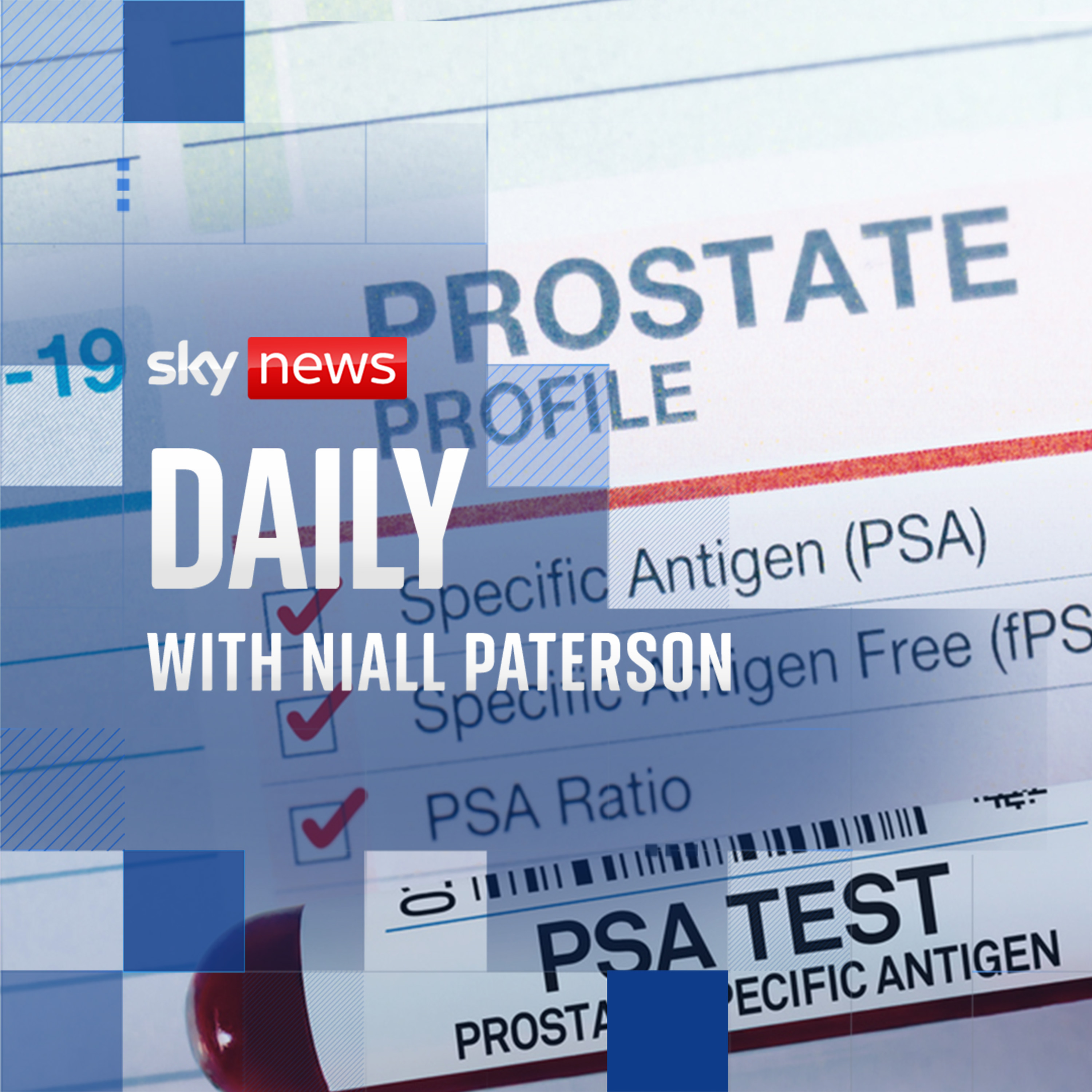 Why David Cameron’s calling for more cancer screening Why David Cameron’s calling for more cancer screening