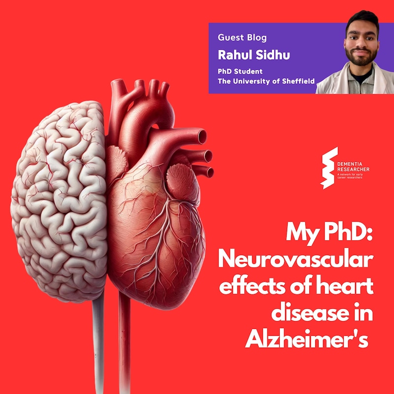 Artwork for podcast Dementia Researcher Blogs