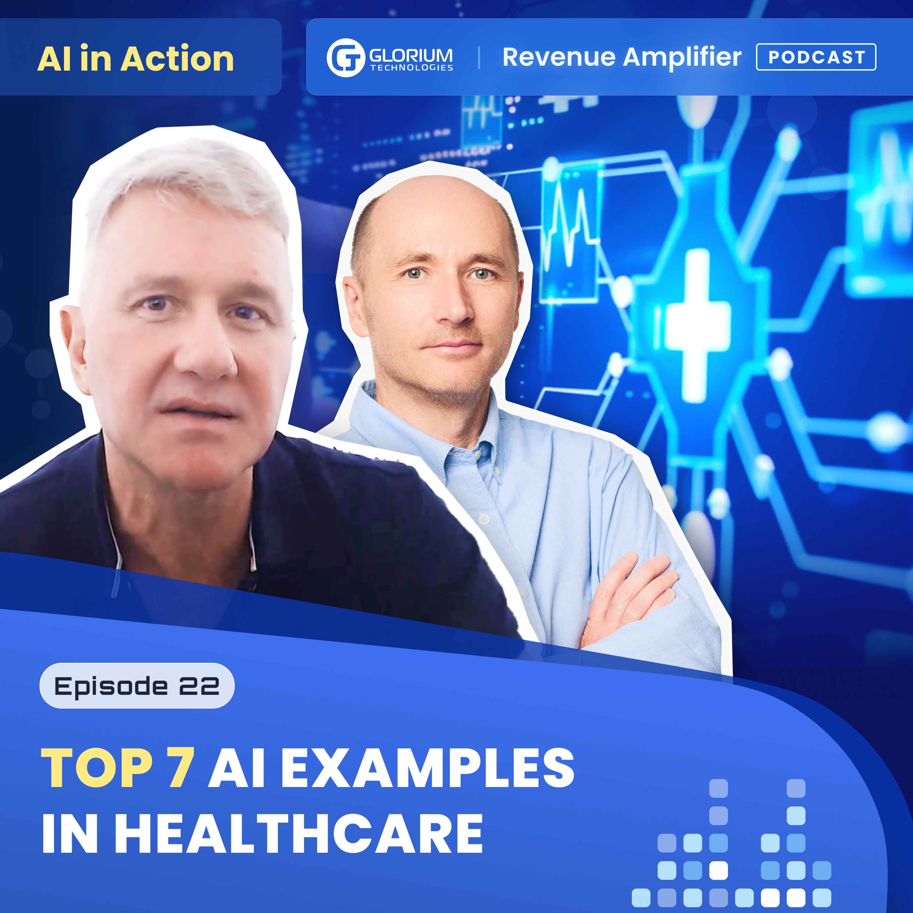Revenue Amplifier